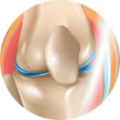 bone image
